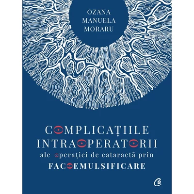 Complicatiile intraoperatorii ale operatiei de cataracta prin facoemulsificare - Dr. Ozana Moraru