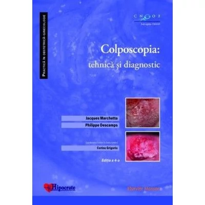 Colposcopiaa. Tehnica si diagnostic